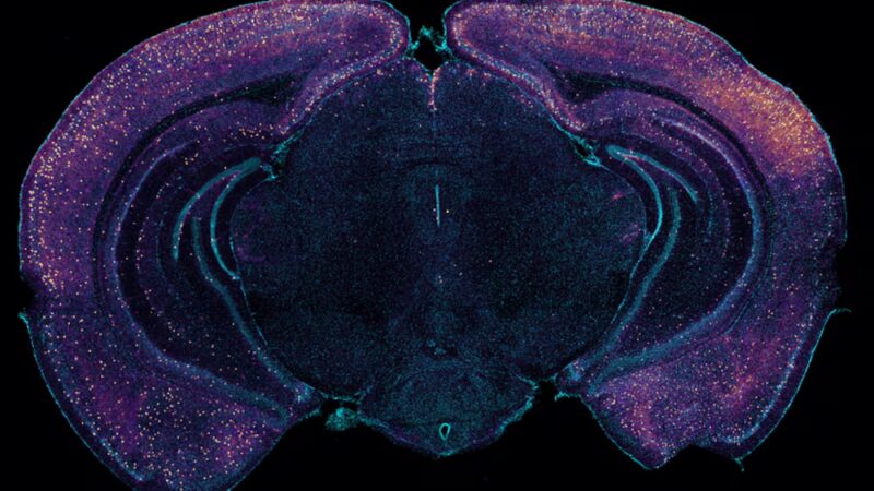 Aseguran que un microbioma intestinal envejecido empeora la memoria