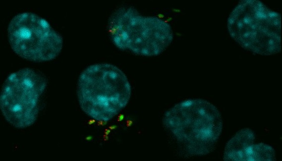 Microbiología: descubren cómo optimizar la multiplicación de la bacteria de la brucelosis