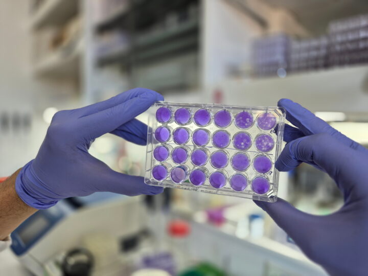 Hallan un mecanismo común de replicación para los virus del dengue, Zika y fiebre amarilla