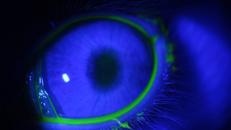 Científicos trabajan en la optimización del tratamiento contra el glaucoma