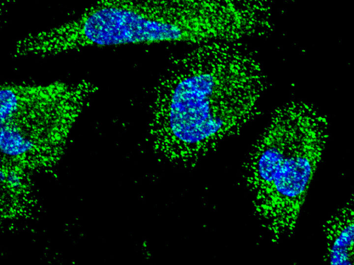 Descubren cómo se comunican las células del cáncer pancreático para sobrevivir a condiciones adversas